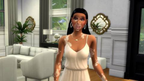 Free Sims 4 update adds vitiligo skin details with Winnie Harlow collaboration