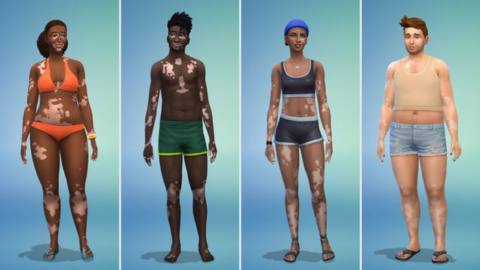 Sims 4 Adds Vitiligo Skin Options In Free Update