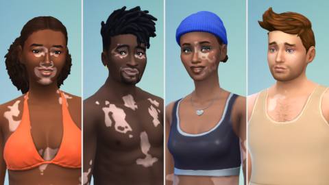 The Sims 4 free update adds vitiligo skin details in continued effort for more inclusive character creation
