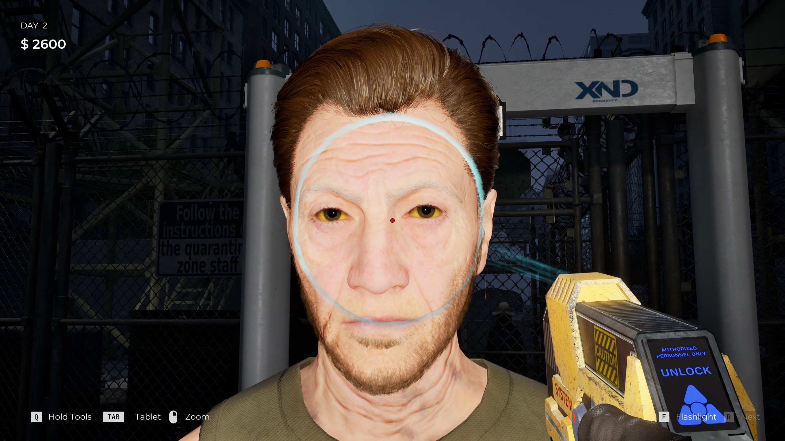 A person with yellow eyes being scanned with a medical device